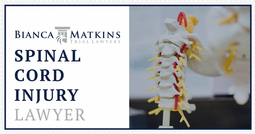 Baton Rouge Spinal Cord Injury Lawyer - Bianca | Matkins